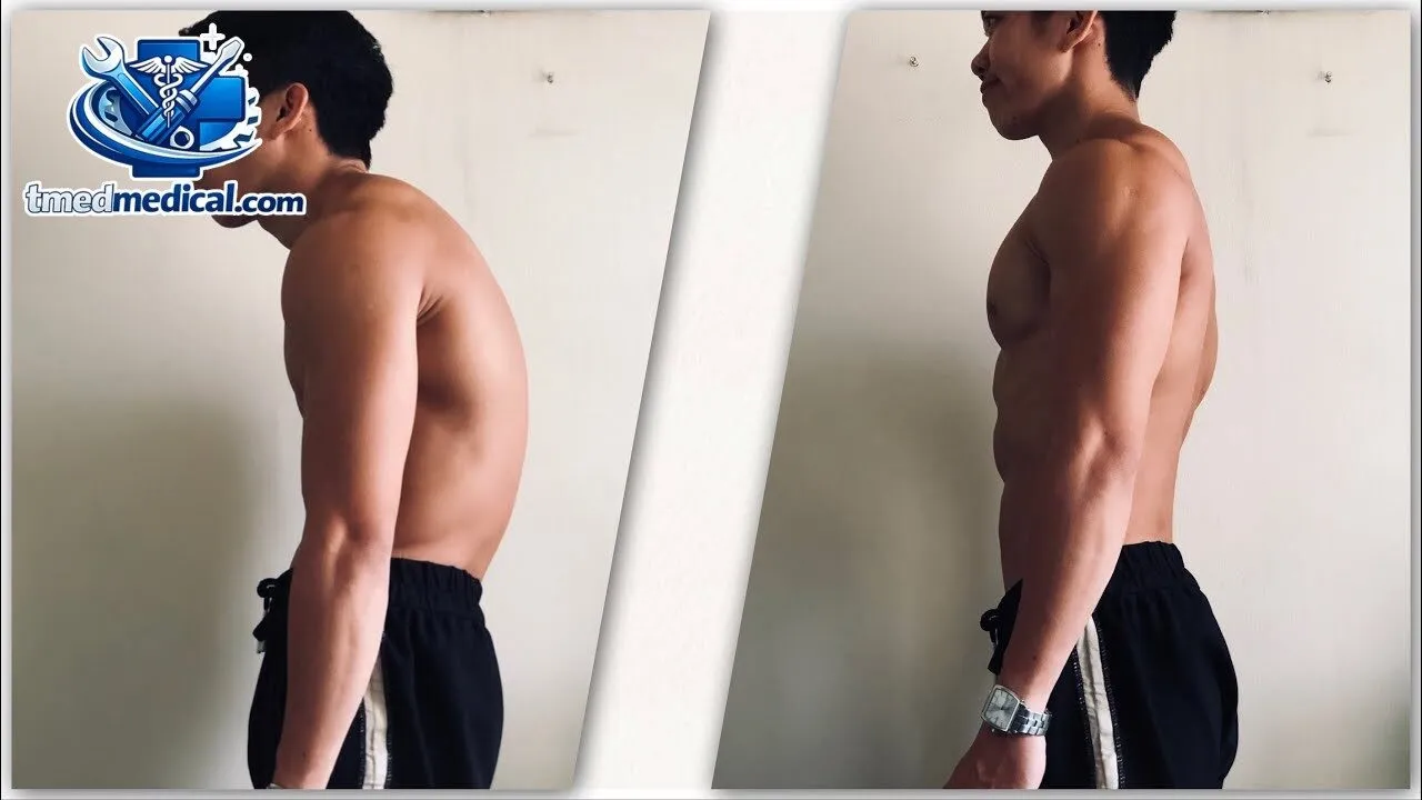 hướng dẫn bài tập rụt cổ giúp cải thiện gù lưng